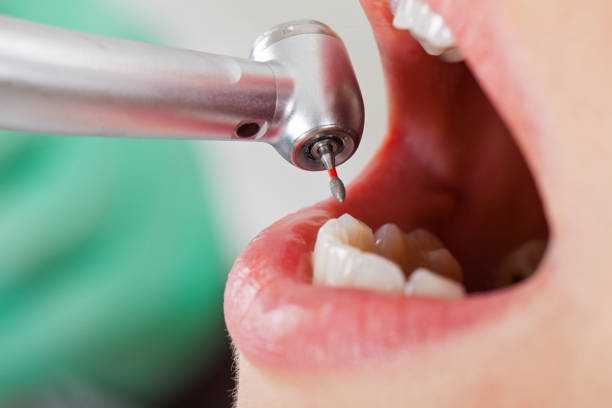 Best Pediatric Emergency Dentist in Pine Crest, TN